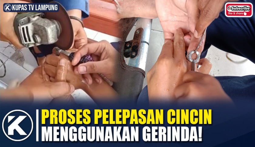 Petugas Damkar Bantu Lepaskan Cincin Warga Pakai Gerinda